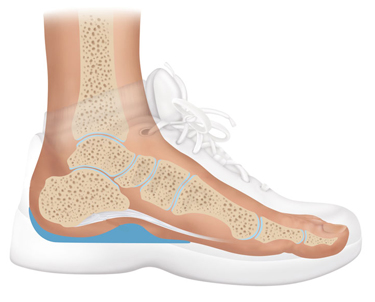 Gel Heel Seat shoe inserts provide fascia support