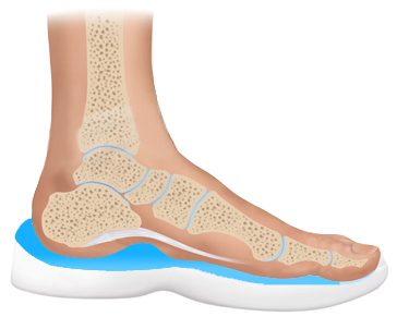 Fascia bar heel pain relief