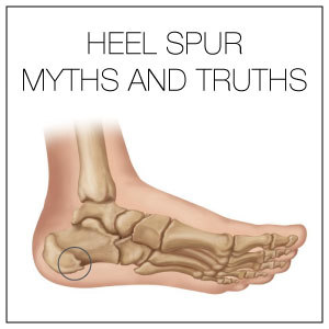 Heel Spur Myth and Truth