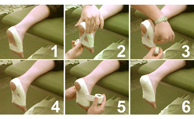 Plantar Fasciitis Foot Taping Technique Diagram