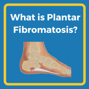 What is Plantar Fibromatosis